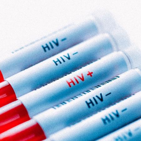 Pesquisadores brasileiros devem retomar estudo que busca a cura do HIV ainda neste ano