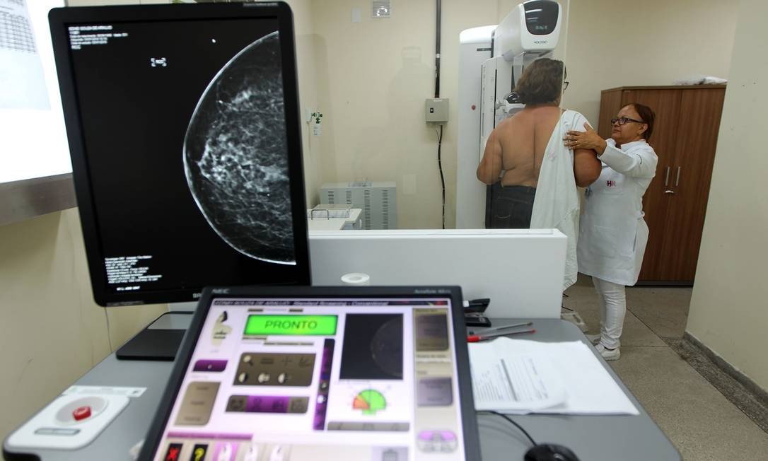 Mulheres devem esperar 4 semanas após vacina para fazer mamografia de rotina