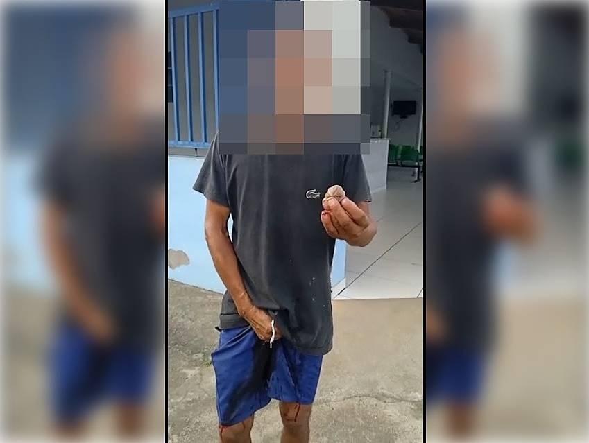 Bahia: Homem que aparentar ter problema psiquiátrico arranca órgão genital para pagar dívida em Santa Luzia