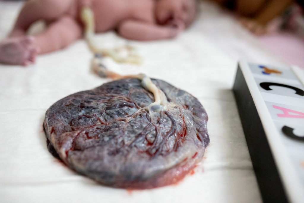 placenta