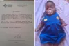 Mãe pede ajuda para custear tratamento e cirurgia de bebê com má-formação congênita em Santo Antônio de Jesus